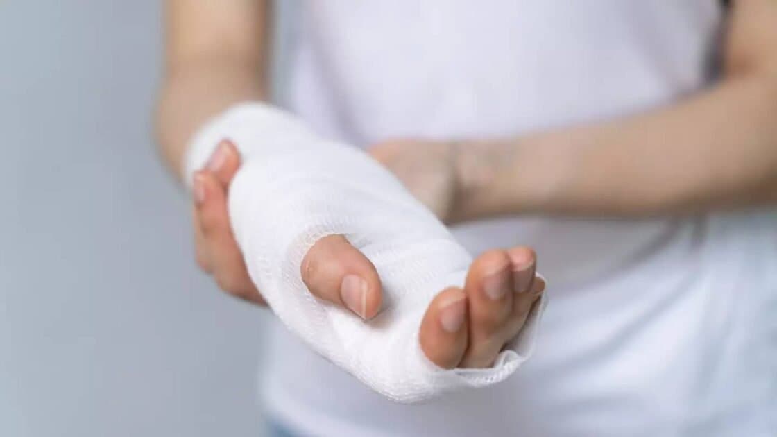 Shkencëtarët kinezë prezantojnë ngjitës kockash që riparon frakturat brenda 3 minutash