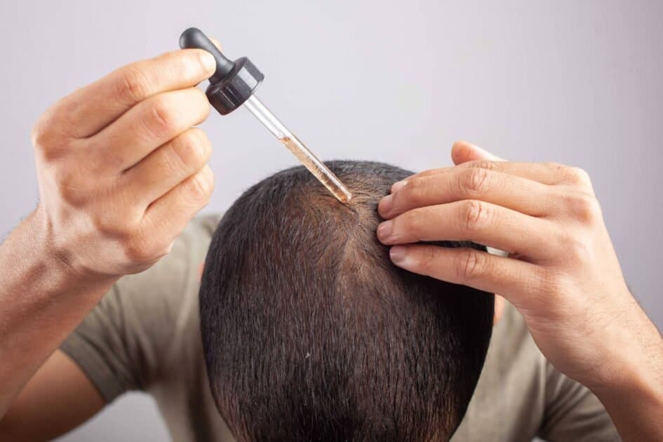 Shkencëtarët tajvanezë zbulojnë serum që rikthen flokët brenda 20 ditësh
